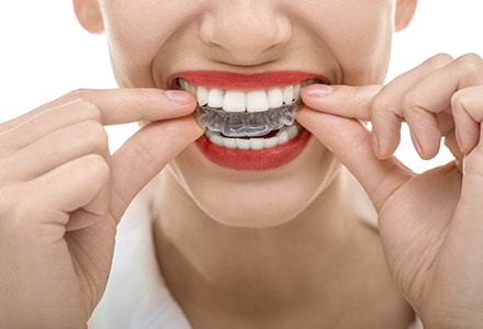 Gutiera Bruxism